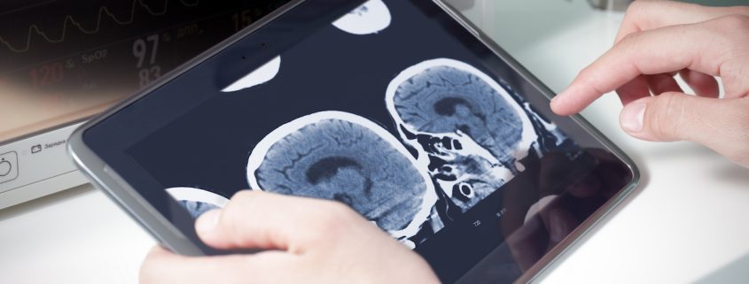 doctor examining a brain cat scan on a digital tablet